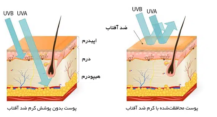 UVA و UVB چه تفاوتی دارند؟